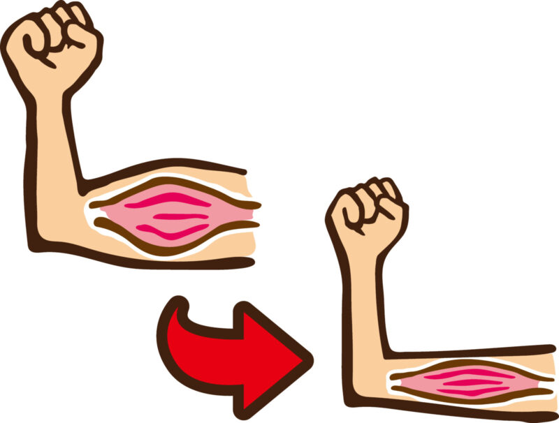 筋肉減少のイラスト